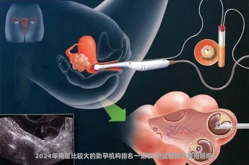 2024年南昌比较大的助孕机构排名一览表,附试管助孕费用明细!