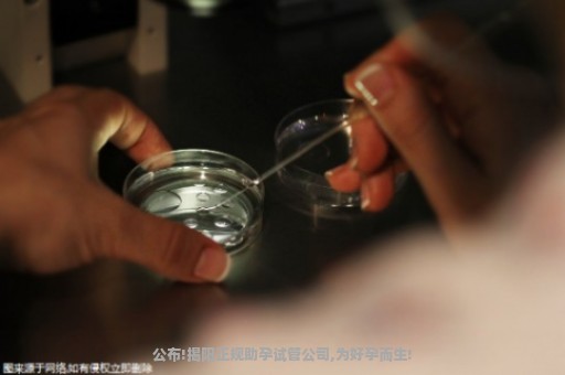 公布!揭阳正规助孕试管公司,为好孕而生!