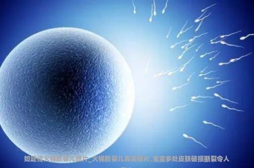 如懿传火棉胶婴儿图片_火棉胶婴儿真实图片,宝宝多处皮肤破损断裂令人揪心