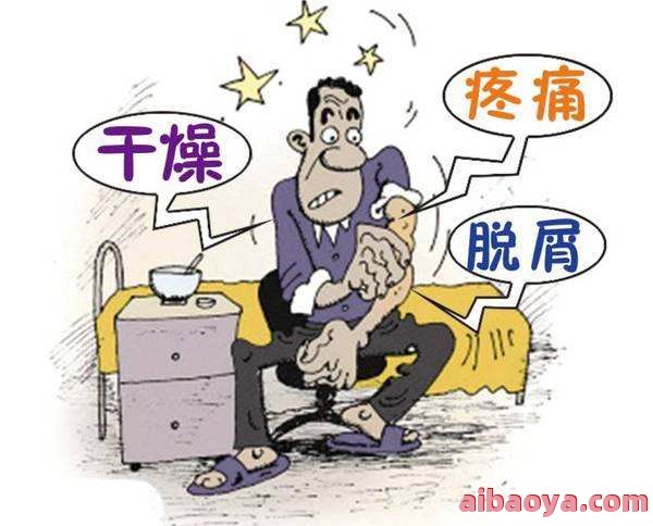 成都牛皮癣医院官网是什么_简介_专家挂号