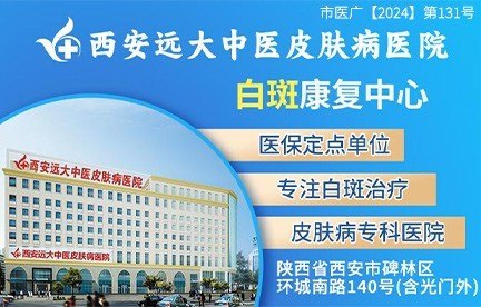 大同白癜风医院官网是什么_简介_专家挂号