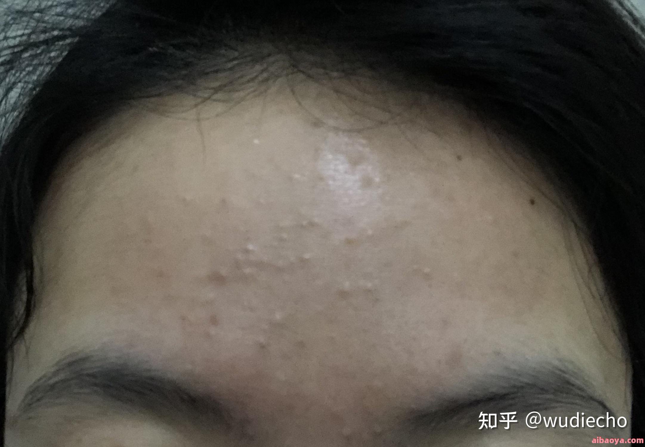 北京皮肤病医院医生预约挂号_出诊时间
