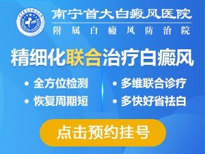 柳州白癜风医院官网是什么_简介_专家挂号