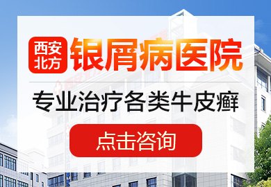 西安银屑病医院医生预约挂号_出诊时间