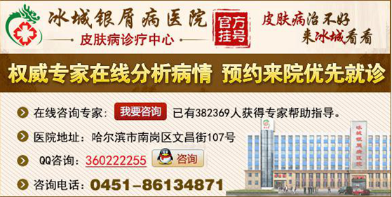 宁波银屑病医院官网是什么_简介_专家挂号