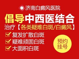 济南白癜风医院官网是什么_简介_专家挂号