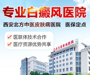 嘉兴白癜风医院官网是什么_简介_专家挂号