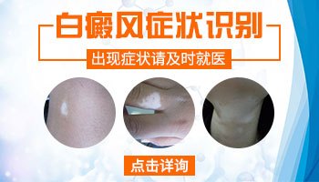 石家庄白癜风医院医生预约挂号_出诊时间